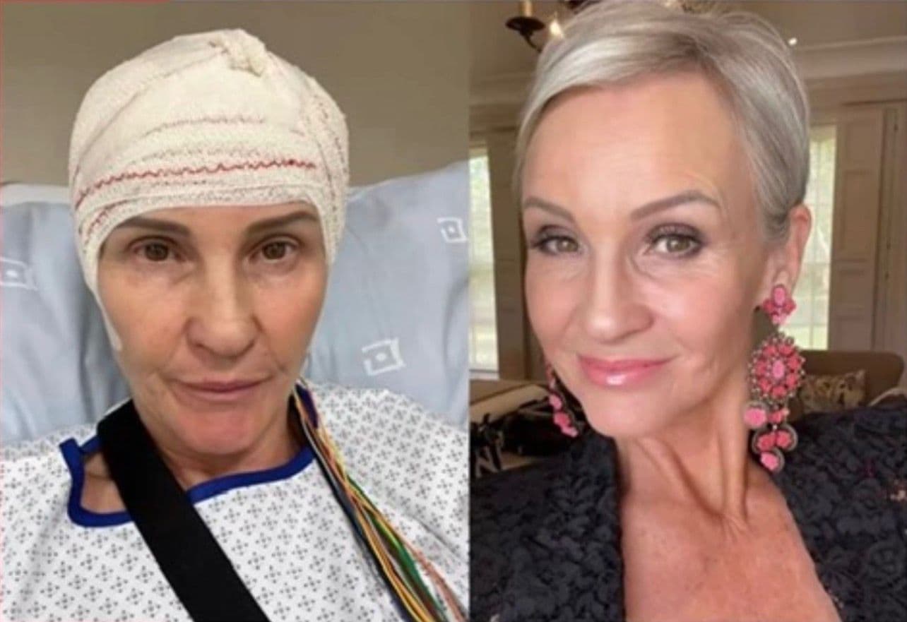 Linda Paige in hospital with a bandage around her head, beside a later photograph of her well and styled.